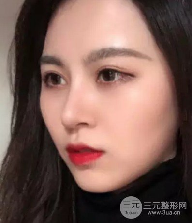 隆鼻修复手术价格多少