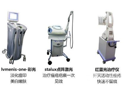 激光去痘痘多少钱