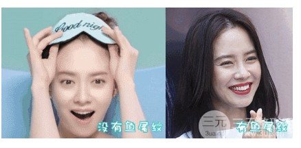 鱼尾纹去除的医美方式