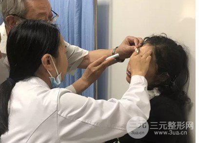 抽脂去除眼袋降低风险吗