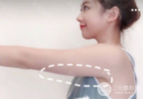 怎么瘦手臂