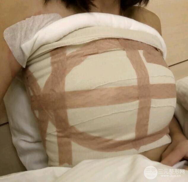 北京八大处整形医院整形案例2：