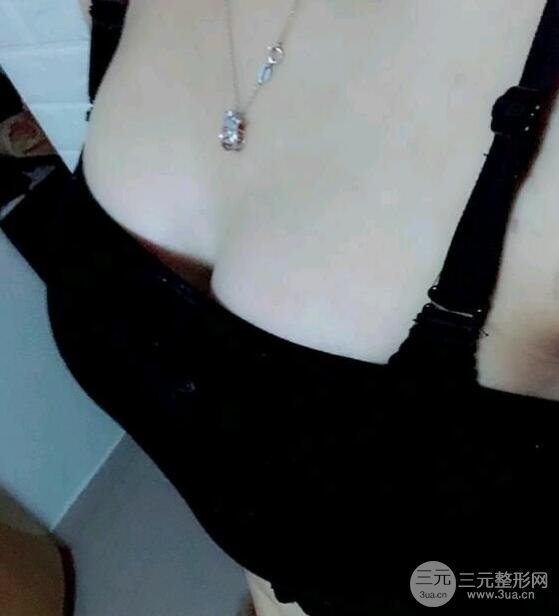 北京八大处整形医院整形案例2：