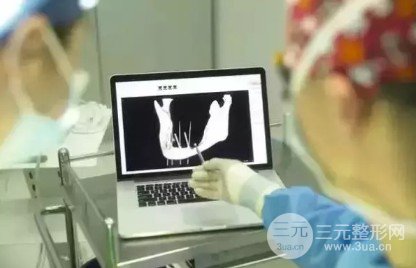 牙科拆线多少钱