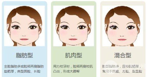 注射瘦脸