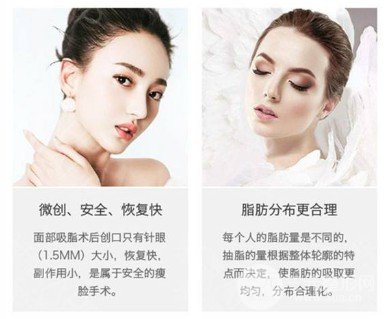 面部吸脂的果怎么样