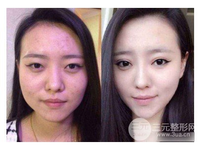 圆脸怎样变瓜子脸