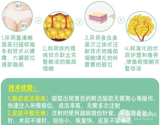 北京东方和谐吸脂贵吗