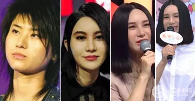 尚雯婕整容前后照片对比