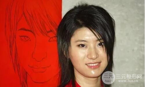 尚雯婕整容前的照片