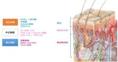 怎样去除痘疤?别乱用药!5种降低风险医美手段参考!