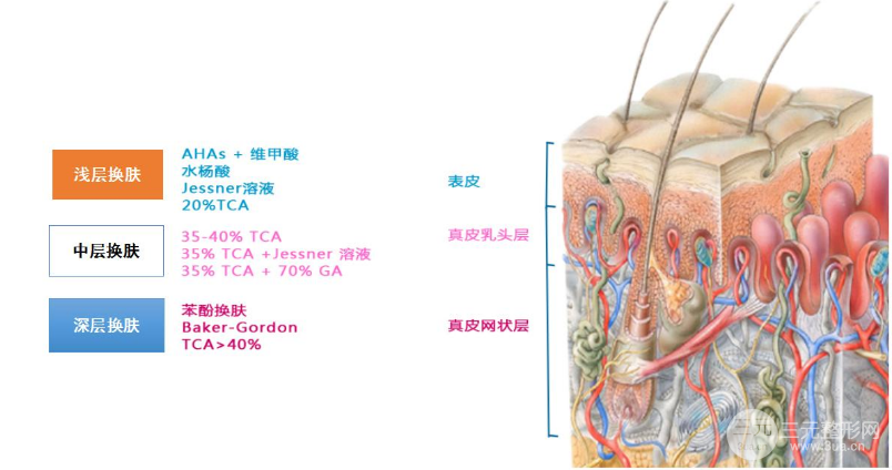果酸焕肤多少钱