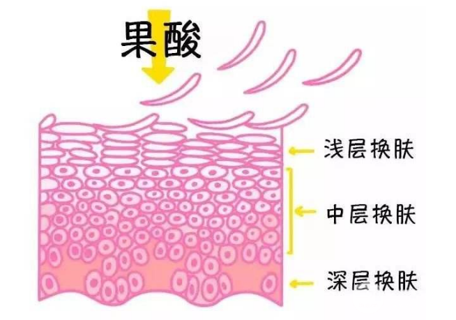 果酸焕肤多少钱