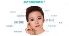 果酸换肤要多少钱？做几次能看到果？