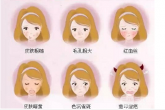 光子嫩肤缓解酒糟鼻果好不好？不要草莓鼻！