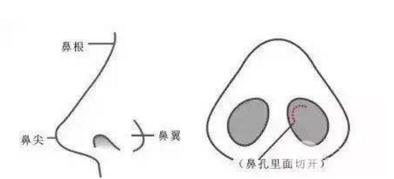 塌鼻子想要变美？教你一招怎样垫高鼻梁！