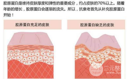注射胶原蛋白