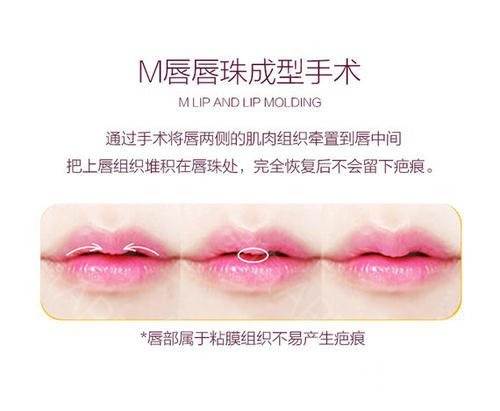 玻尿酸丰唇手术和M唇手术如何选择