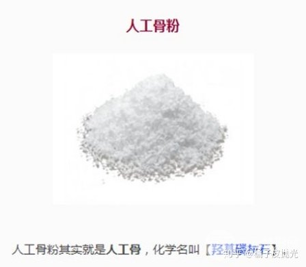 骨粉隆鼻后遗症