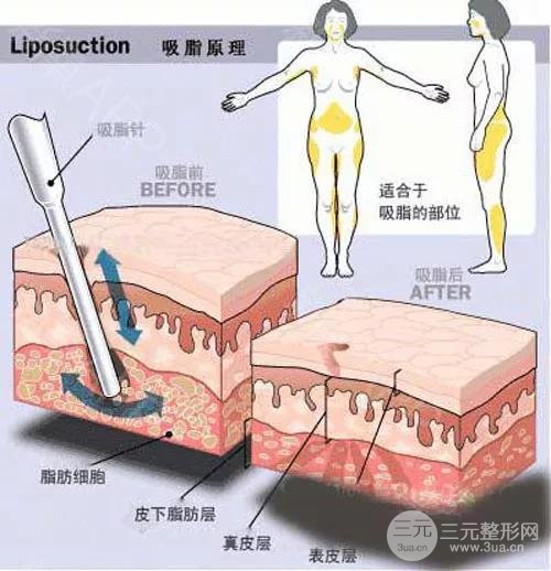 　腰腹部