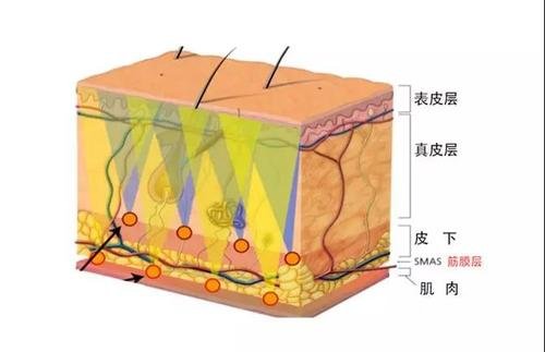 内窥镜除皱手术能保持多久