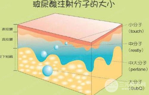 玻尿酸一支多少钱