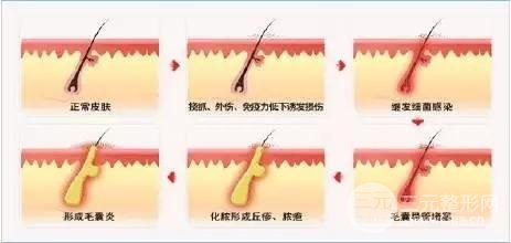 种头发果图