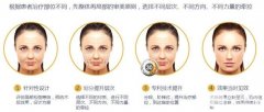 面部除皱术价格贵吗?多少钱?哪种果好? 面部除皱术价格贵吗?多少钱?哪种果好?