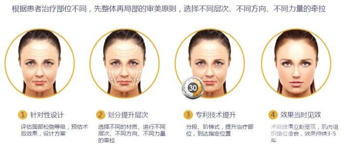 面部除皱术价格