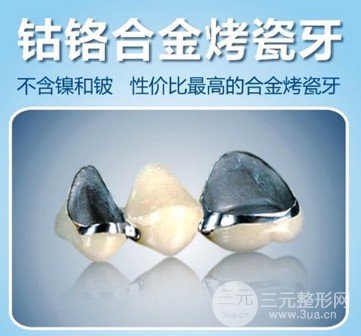 烤瓷牙种类及价格