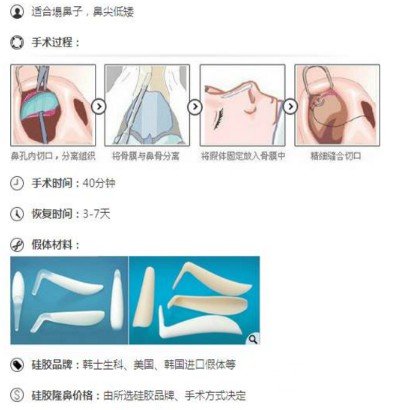 硅胶隆鼻整形术假体