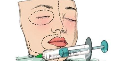 玻尿酸注射除皱果