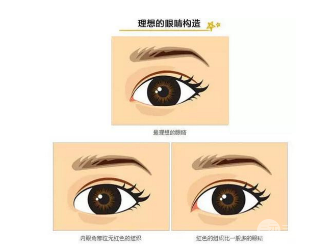 开眼角前后对比照片