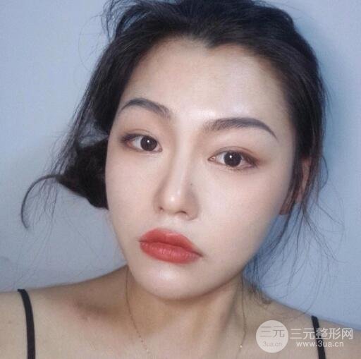 福建省立医院整形美容科专家口碑评价价格表一览丁力隆鼻案例