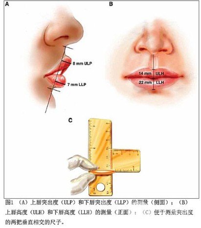 玻尿酸丰唇多少钱一针