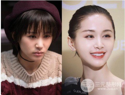 王子文变样被疑整容