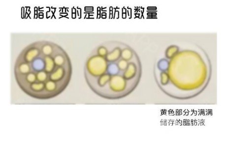 大腿肉注射瘦腿能打吗