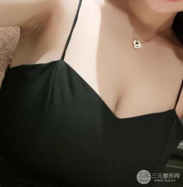 乳房整形案例