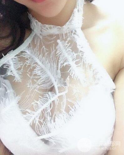隆胸案例