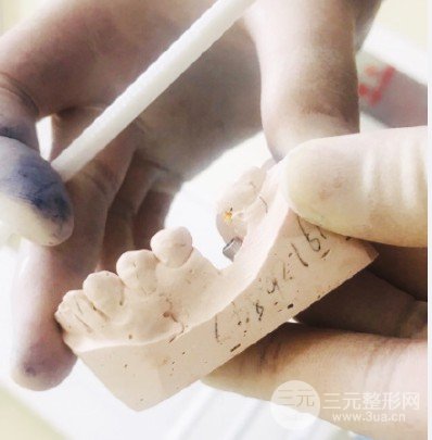 黄冈皓清口腔医院种植牙价格
