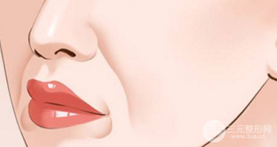 电波拉皮除皱术