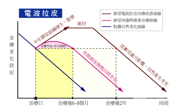 电波拉皮除皱术