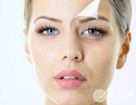 电波拉皮除皱术