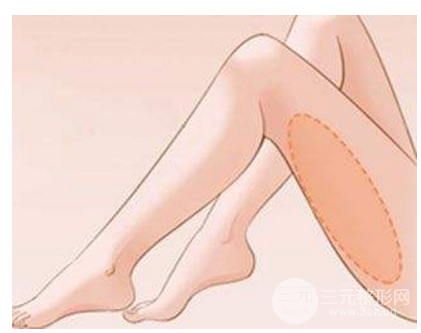腿部吸脂减肥价格