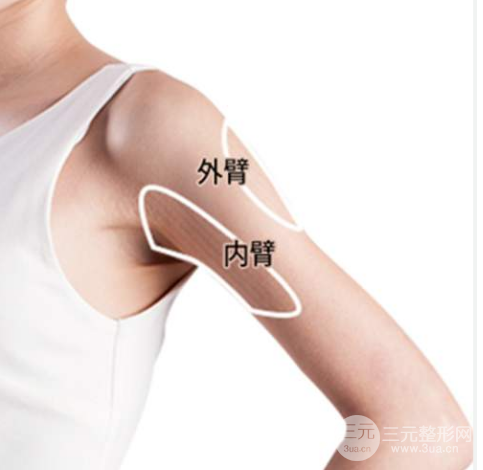 手臂吸脂手术是全麻吗？一般是做什么mz？