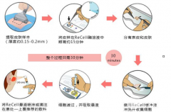 自体细胞注射降低风险吗?360度科普医美技术 自体细胞注射降低风险吗?360度科普医美技术