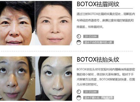 ****注射瘦脸的价格多少