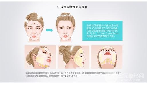 面部除皱除皱多少钱