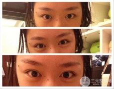 开眼角对比图 小眼放大的秘密，你值得拥有！