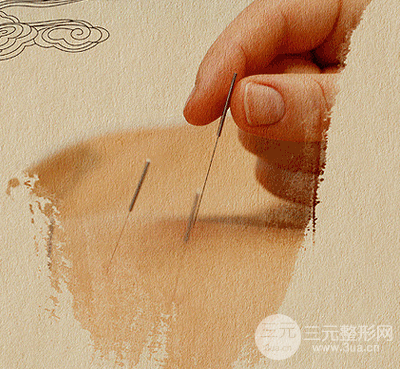针灸除皱